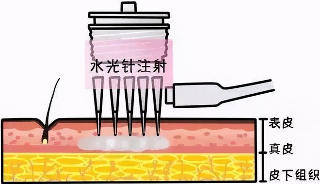 天博体育官方网站2021年最新整容科 采购设备及耗材配置清单(图2)